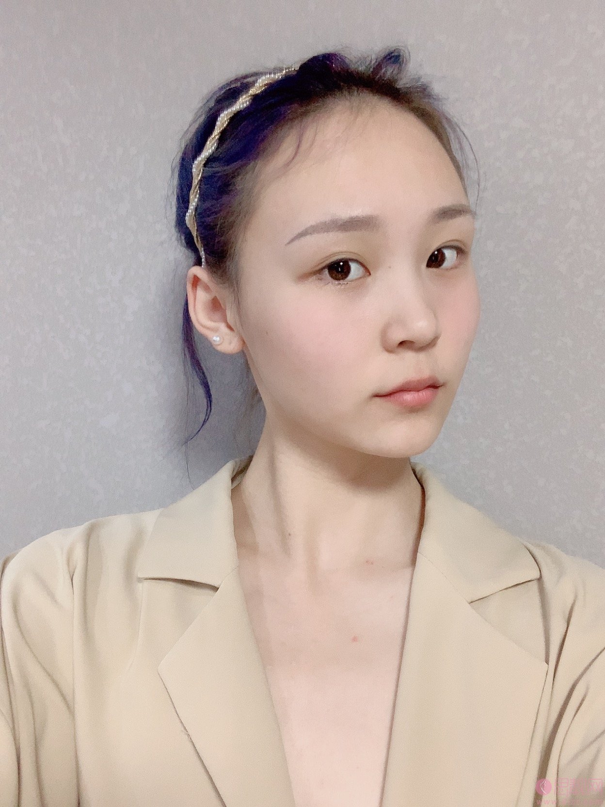 广州珈禾隆鼻案例分享+2021年价格表公布