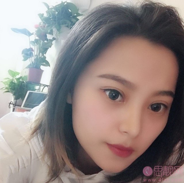 上海九院林明做双眼皮怎么样？附案例分享+2021年价格表公布