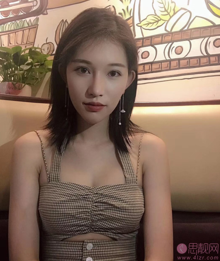 南京华美美容医院假体隆胸案例+2021年价格表公布