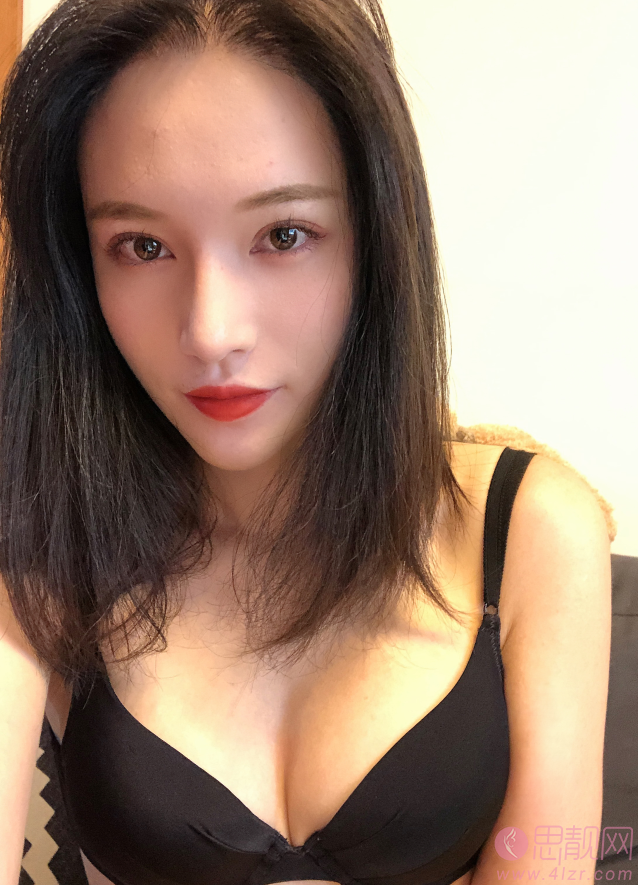 南京华美美容医院假体隆胸案例+2021年价格表公布