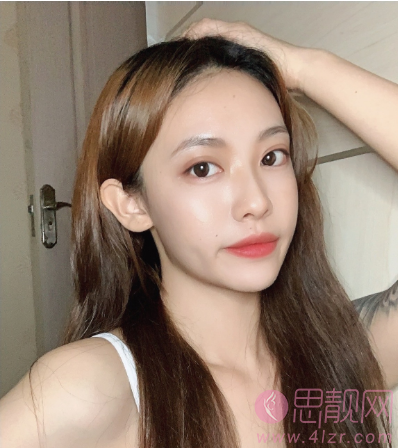 潍坊医学院整形外科医院怎么样?附2021年价格表曝光+双眼皮真人案例反馈