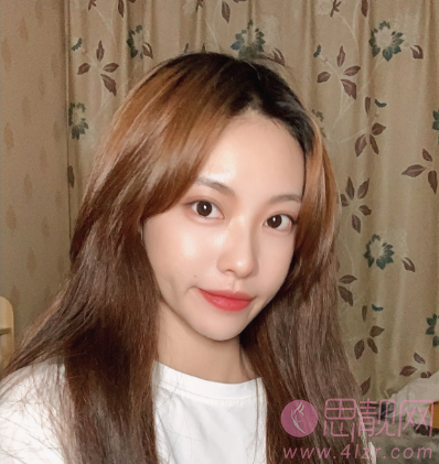 潍坊医学院整形外科医院怎么样?附2021年价格表曝光+双眼皮真人案例反馈