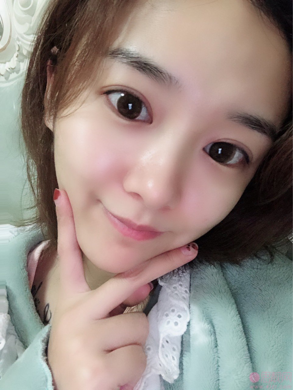 杭州健丽医美做眼袋怎么样？附真人案例一览及2021年价格表曝光