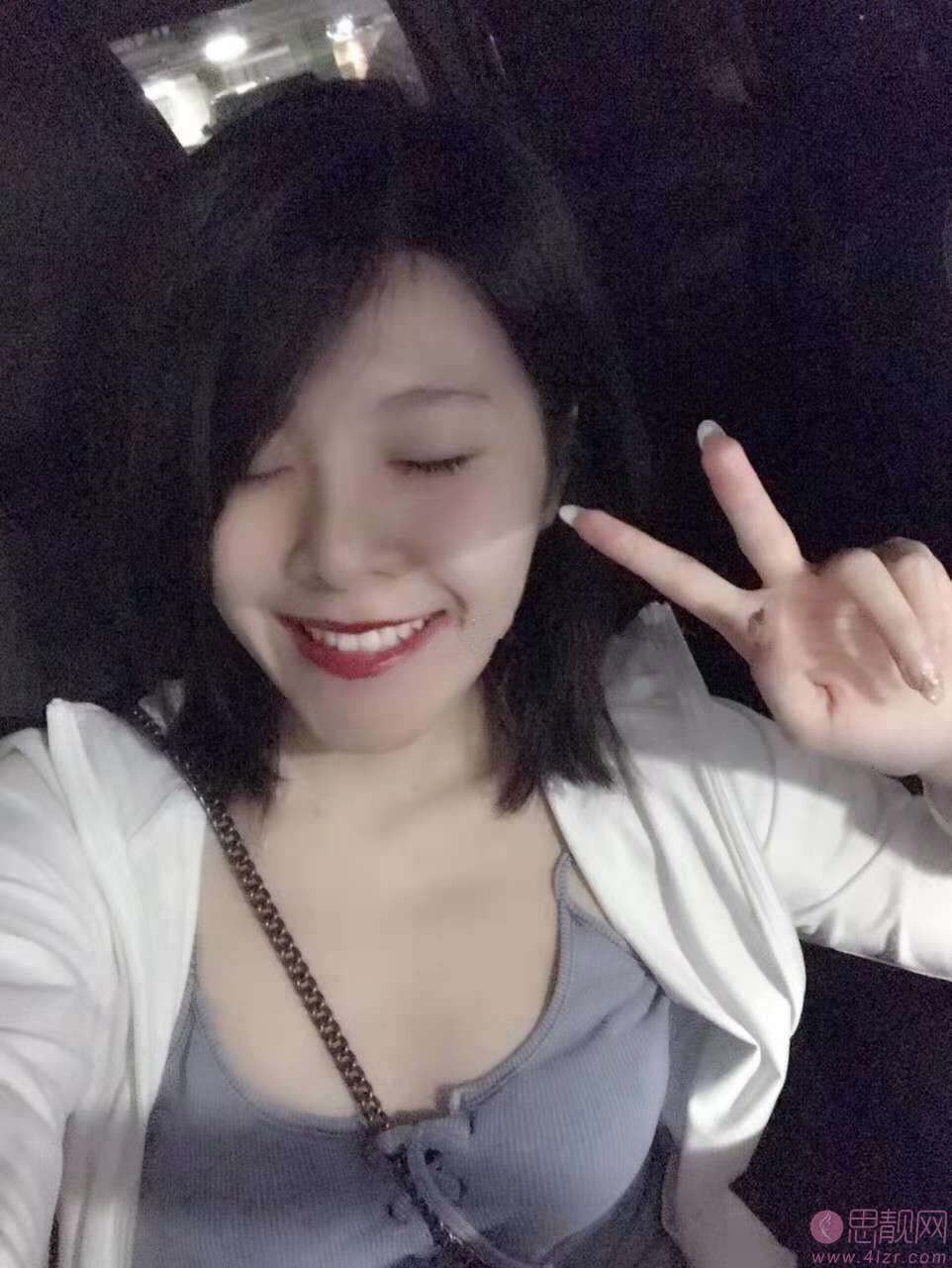 洛阳维乐口腔门诊怎么样？附医院简介及牙齿美白案例分享