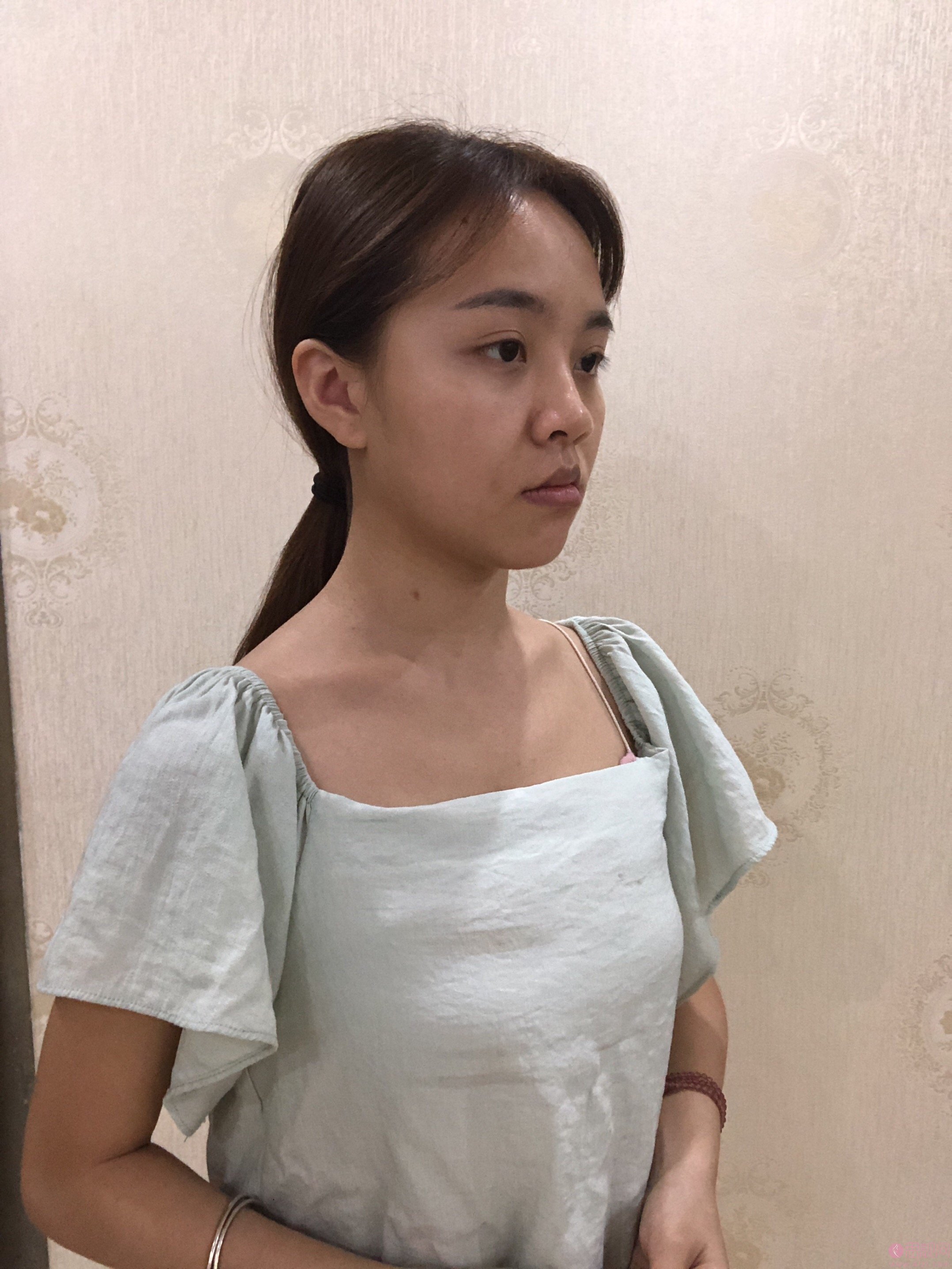 北京蕾士悦医疗美容李海兵隆鼻多少钱?2021年价格表公开