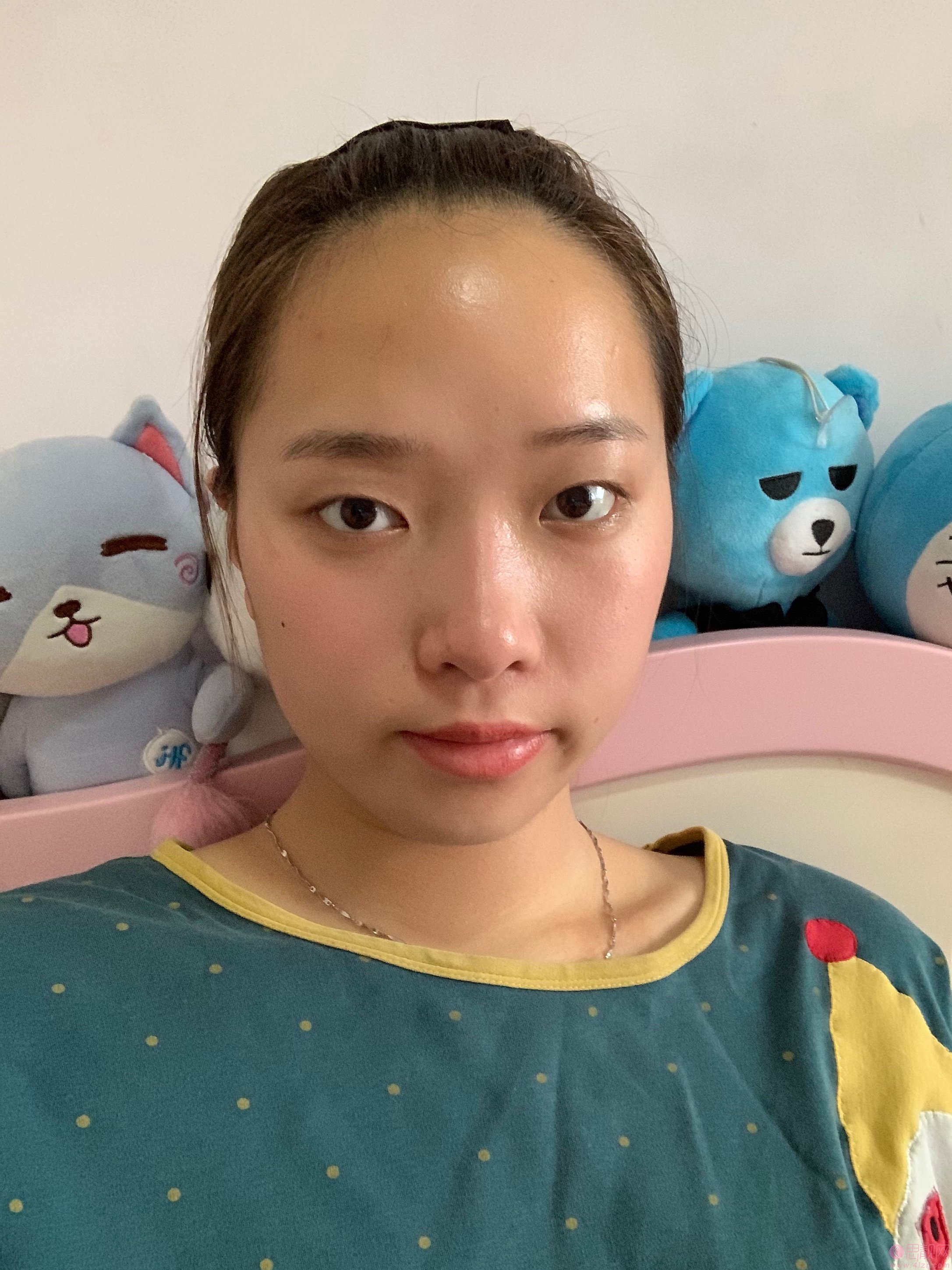 北京做双眼皮比较好的医生有哪些？附医生名单及案例分享
