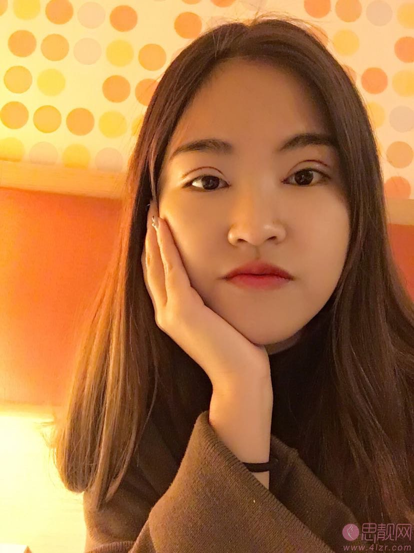 福州爱尔丽整形医院做双眼皮怎么样？