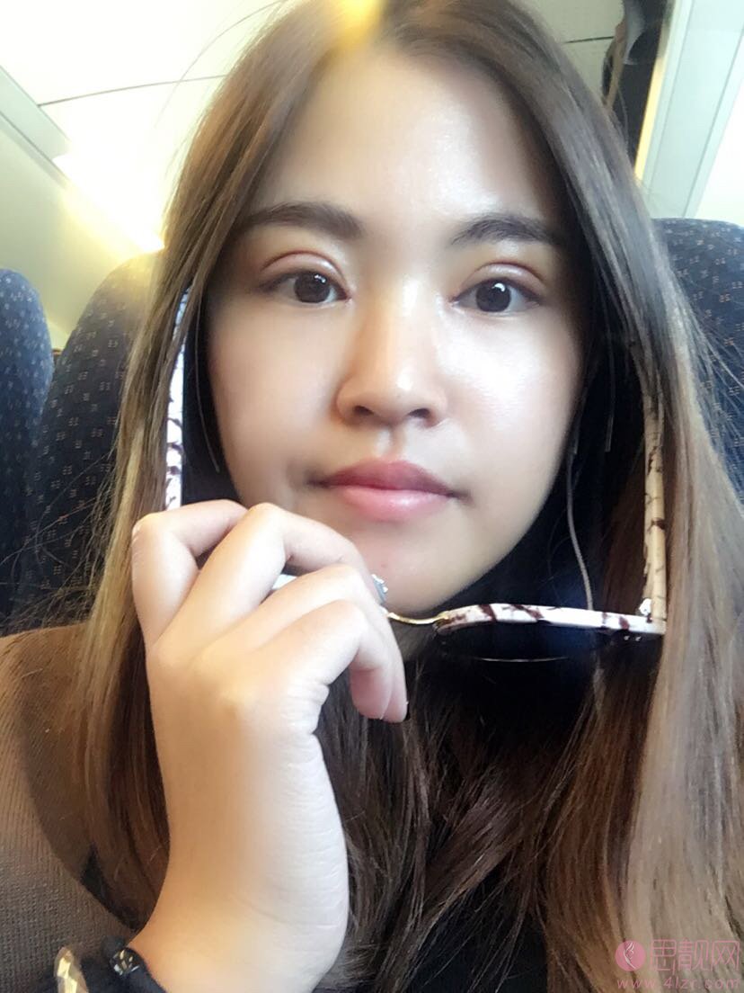 福州爱尔丽整形医院做双眼皮怎么样？