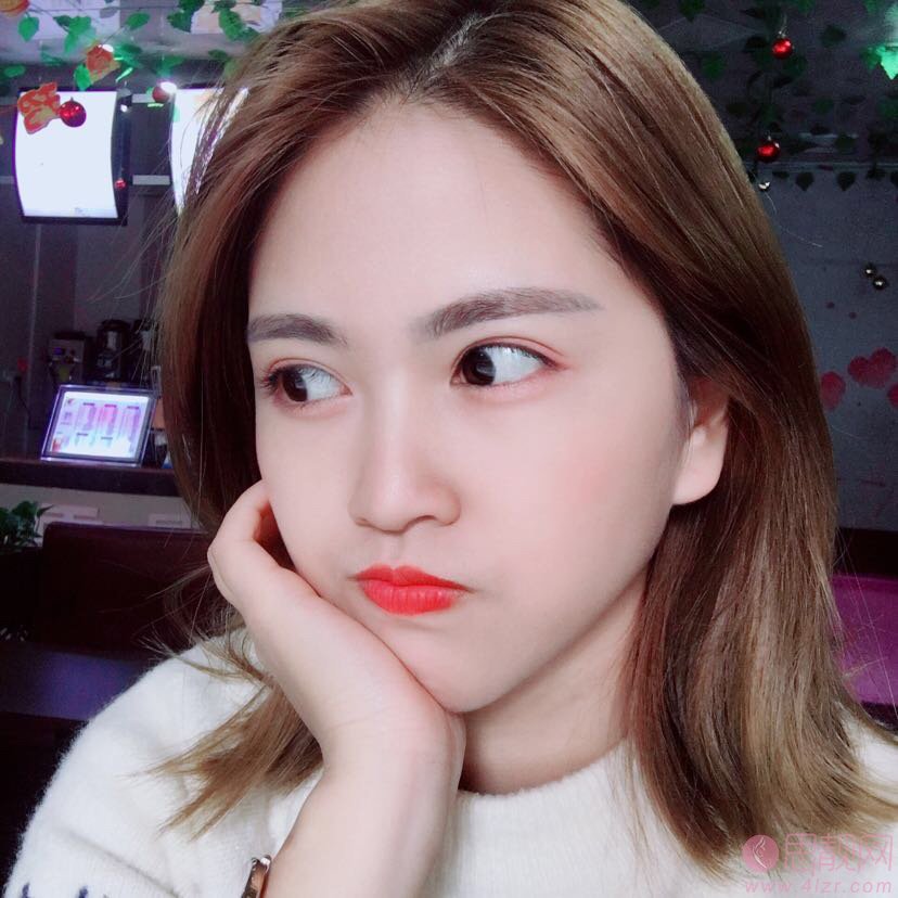 福州爱尔丽整形医院做双眼皮怎么样？