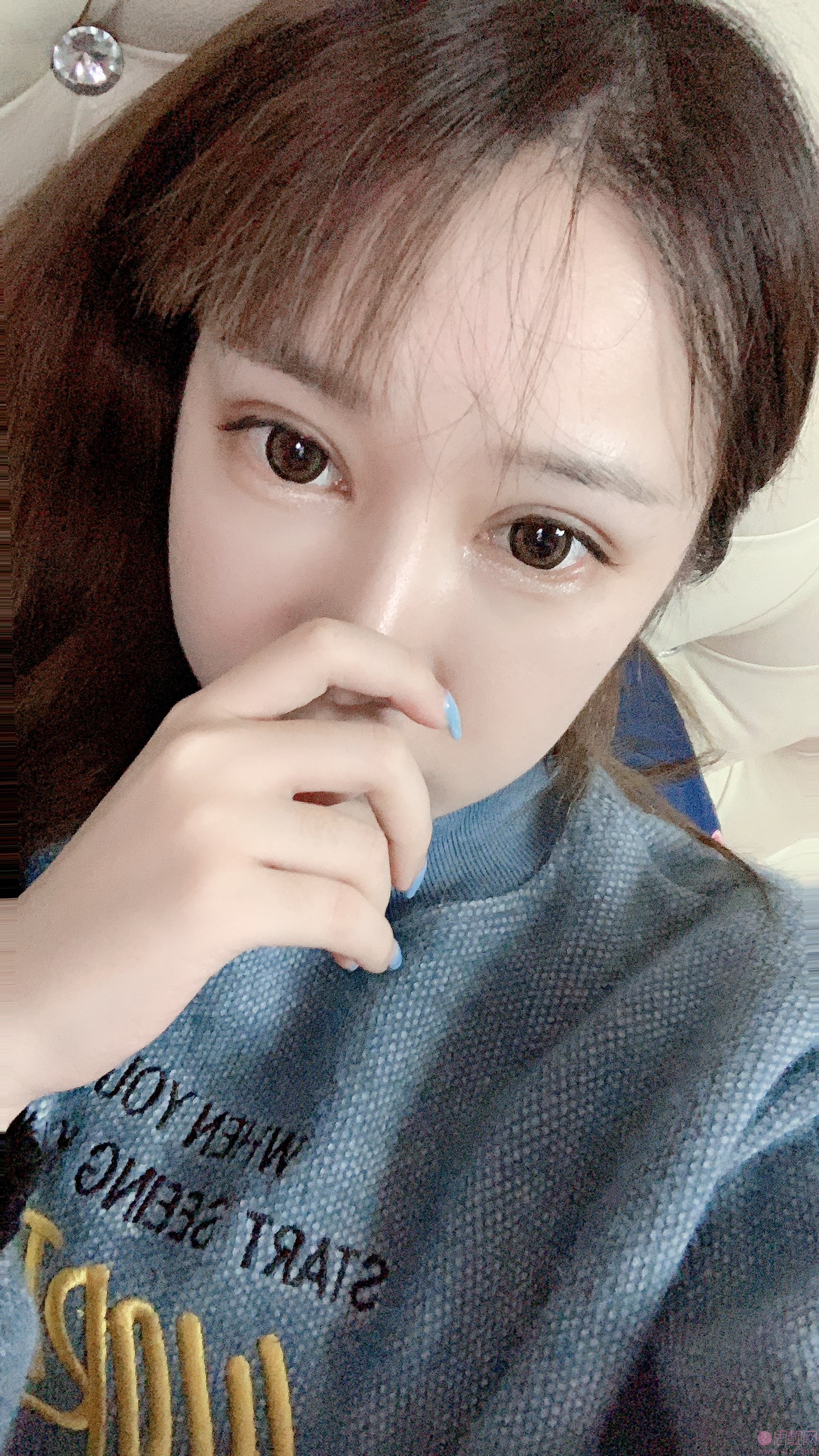 福州爱尔丽整形医院做双眼皮怎么样？2021价格表公布+双眼皮前后效果一览