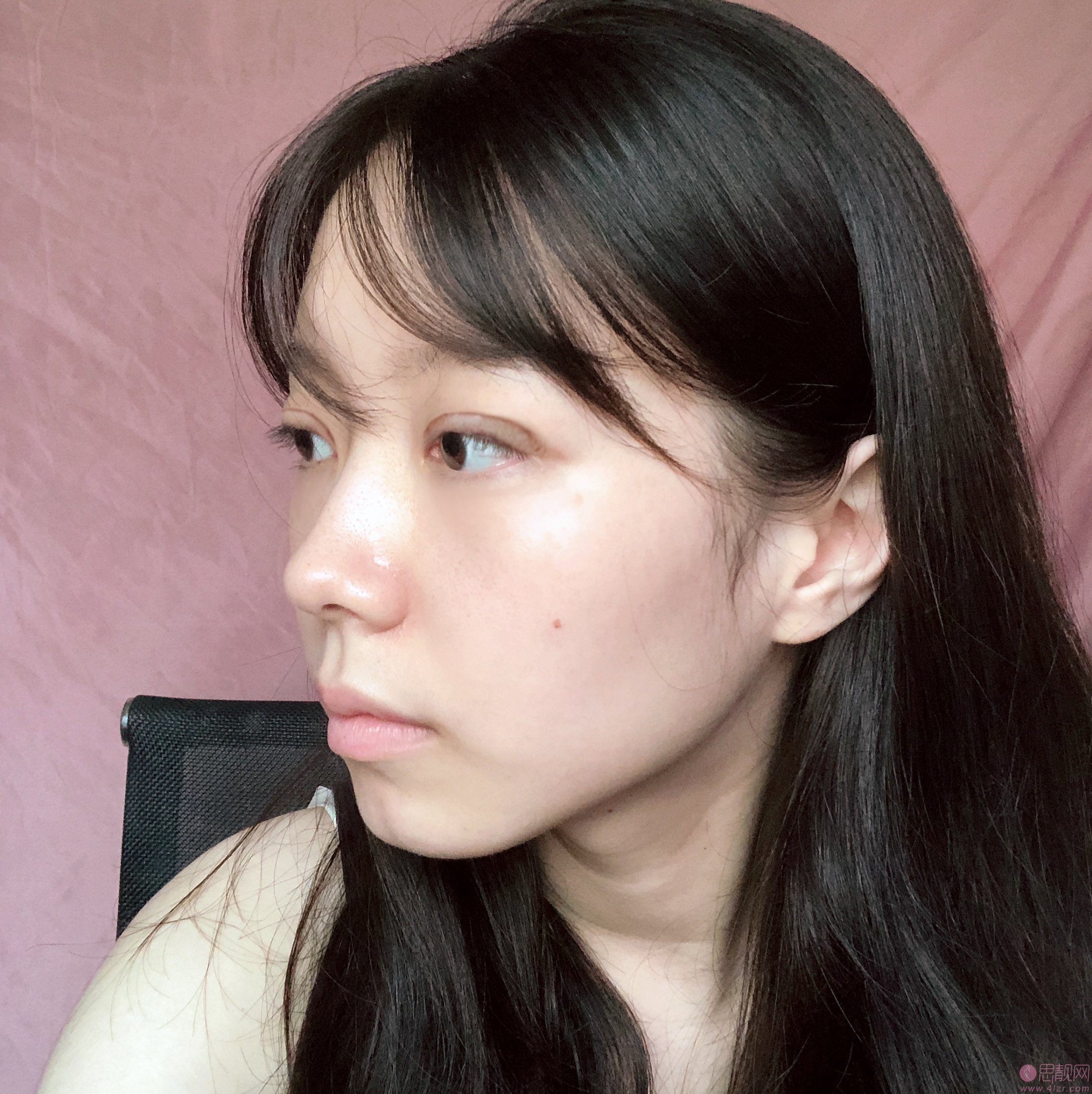 珠江医院整形科陈兵做双眼皮如何？附案例及价格表明细一览