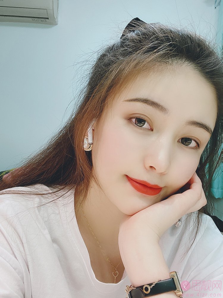 紫馨医疗美容医院梁进华医生自体脂肪填充怎么样?术后效果展示+2021年价格表公开