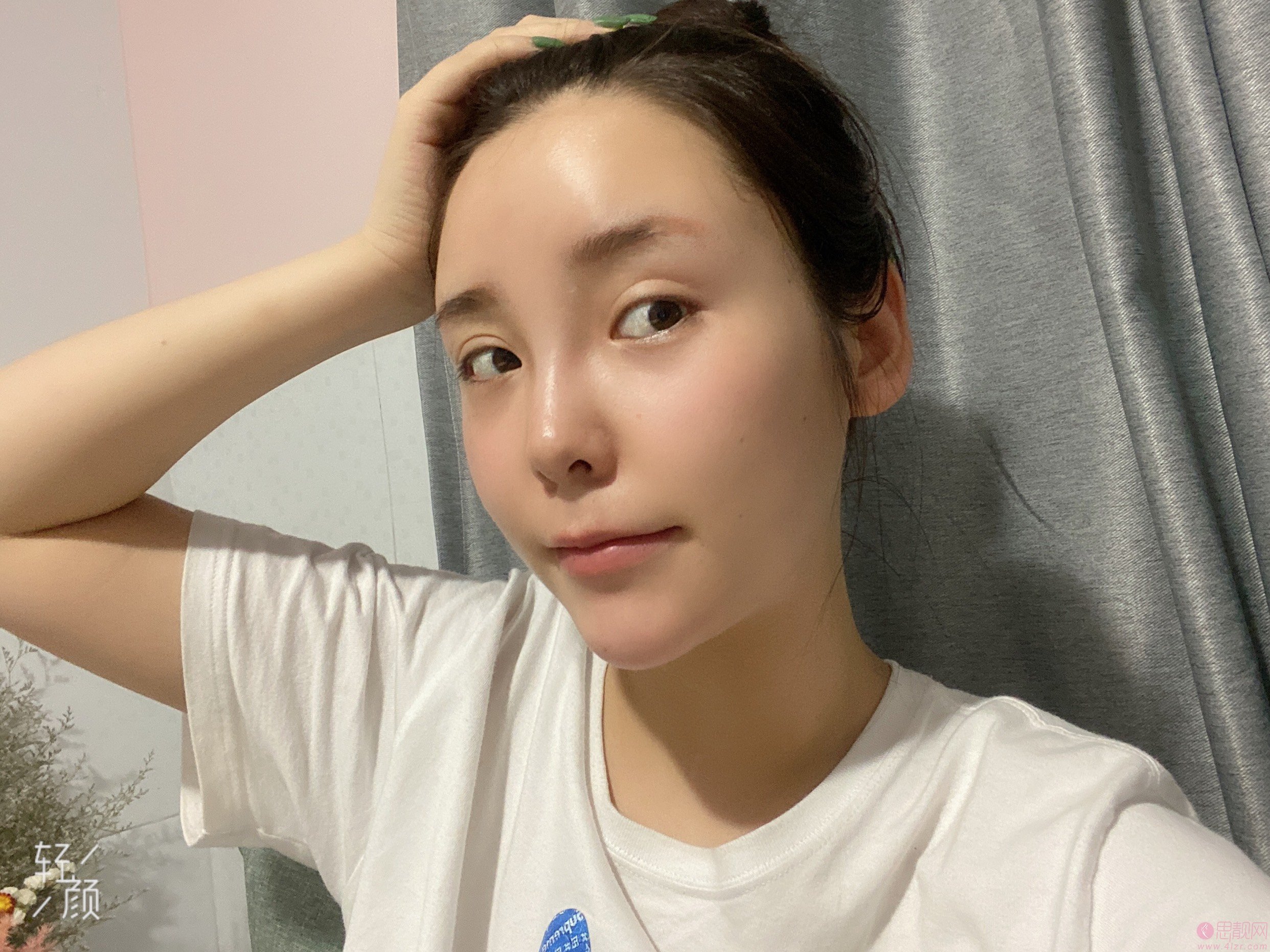 鲁树荣医生脂肪填充怎么样？附案例及价格表一览