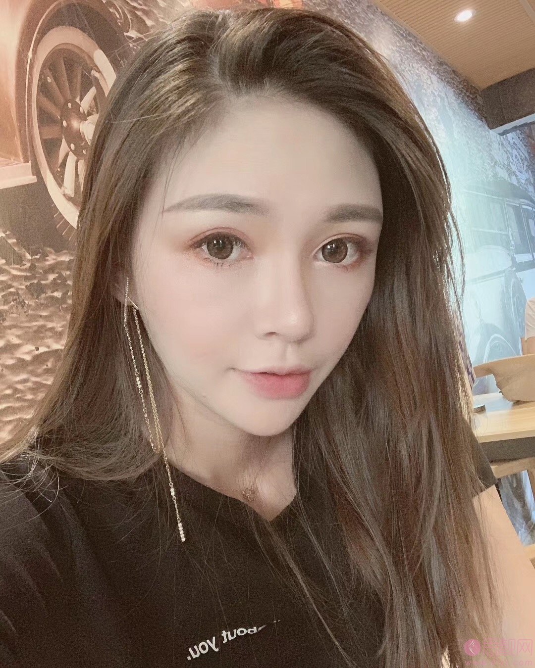 重庆华美整形美容医院怎么样?2021年价格表发布+鼻修复案例分享