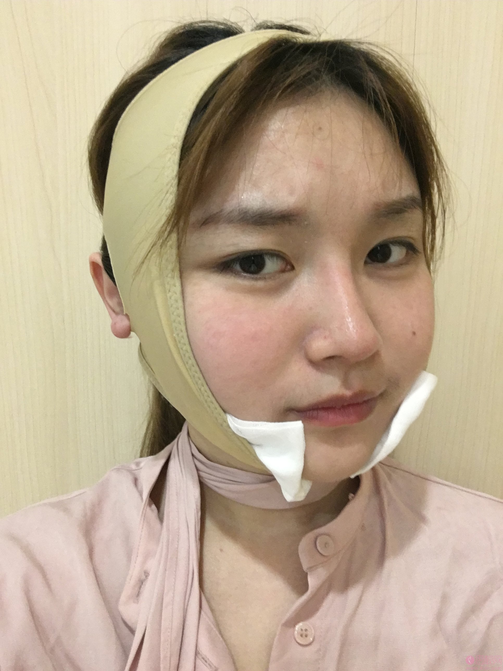 四川省人民医院东篱医院整形美容叶斌医生怎么样?下颌角案例分享+2021年价格表公开