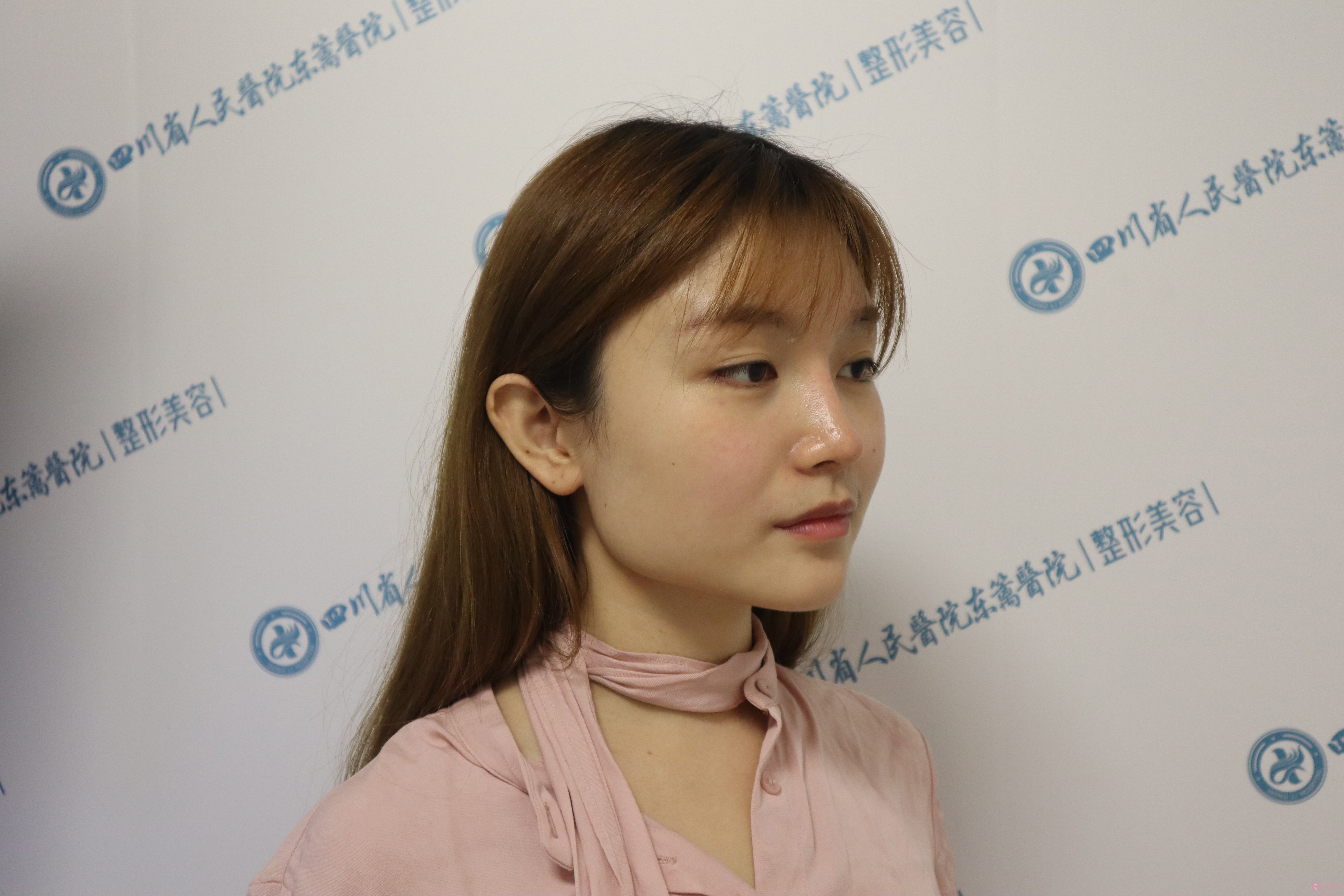 四川省人民医院东篱医院整形美容叶斌医生怎么样?下颌角案例分享+2021年价格表公开