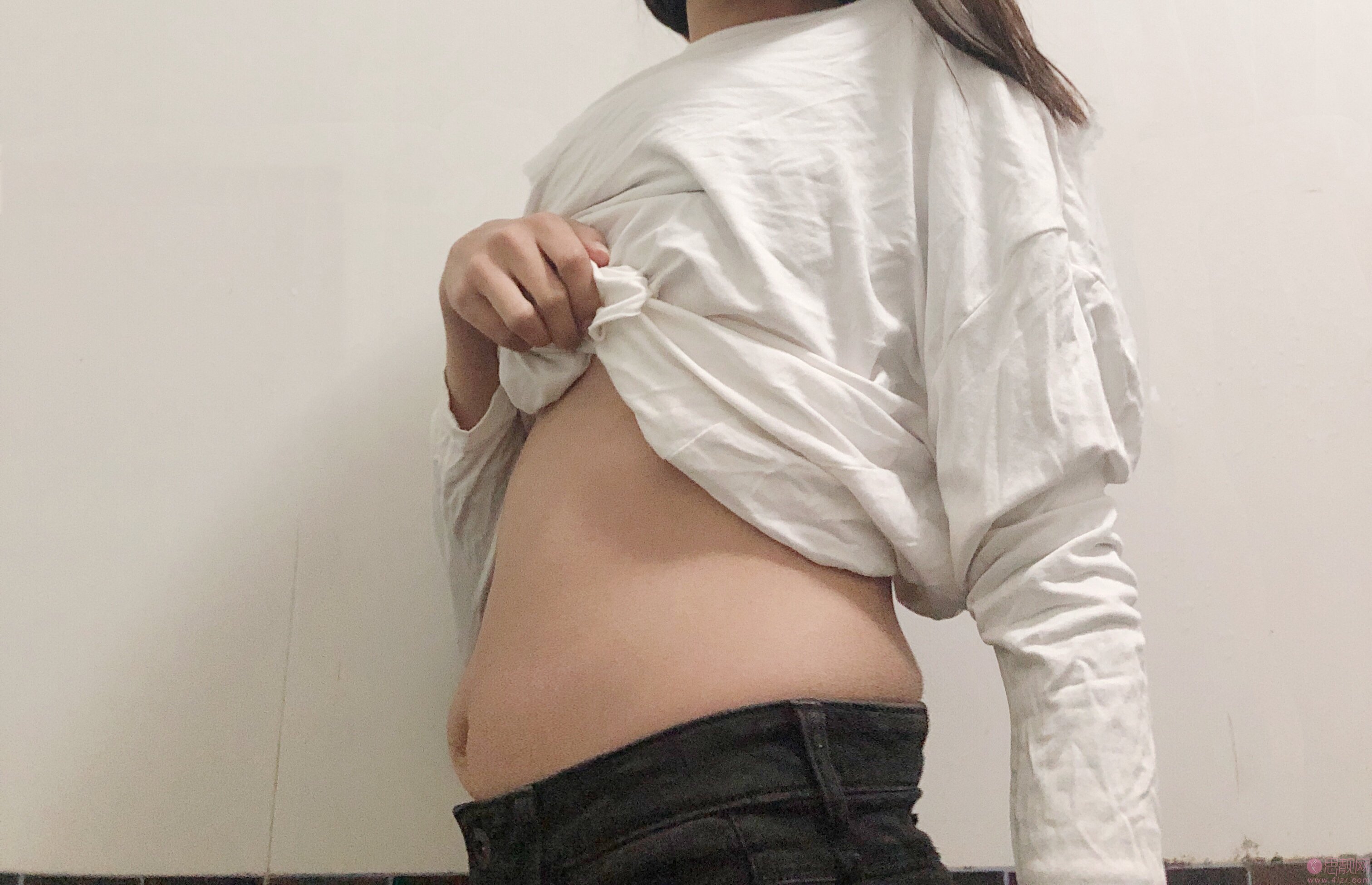 云南梦想整形靠谱吗？是正规医院吗？2021年价格表发布+吸脂瘦腰腹真人案例分享