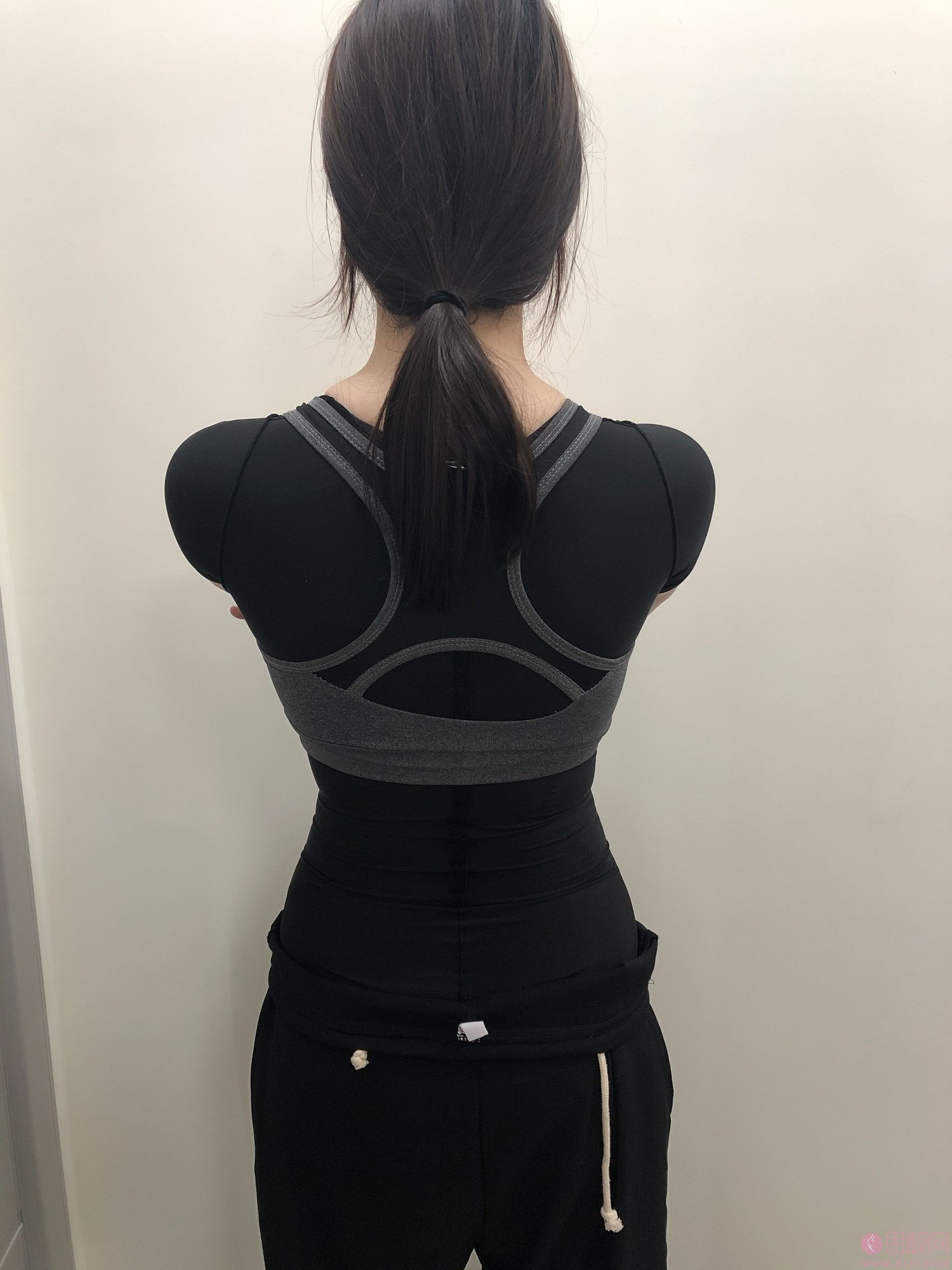 云南梦想整形靠谱吗？是正规医院吗？2021年价格表发布+吸脂瘦腰腹真人案例分享