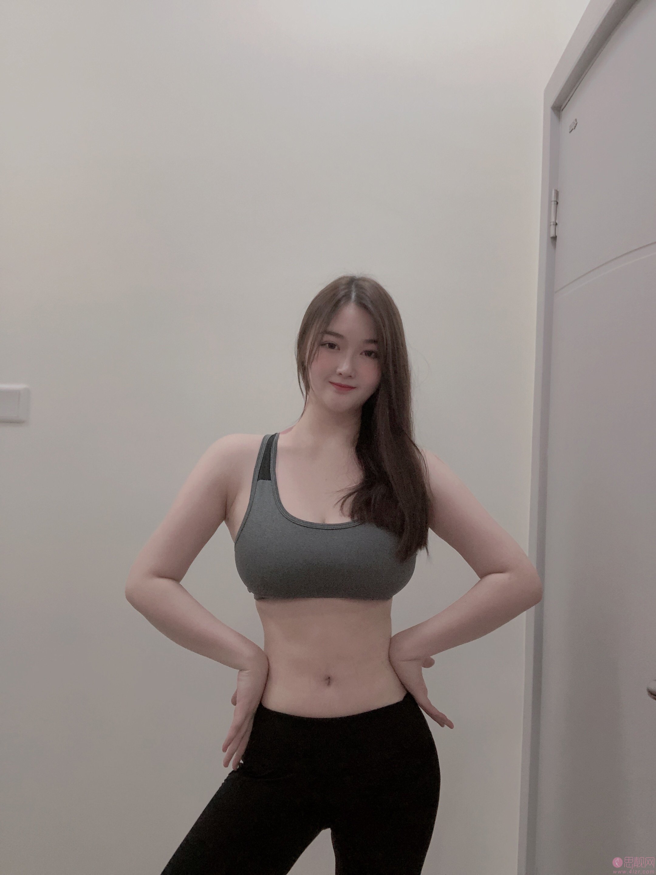 云南梦想整形靠谱吗？是正规医院吗？2021年价格表发布+吸脂瘦腰腹真人案例分享