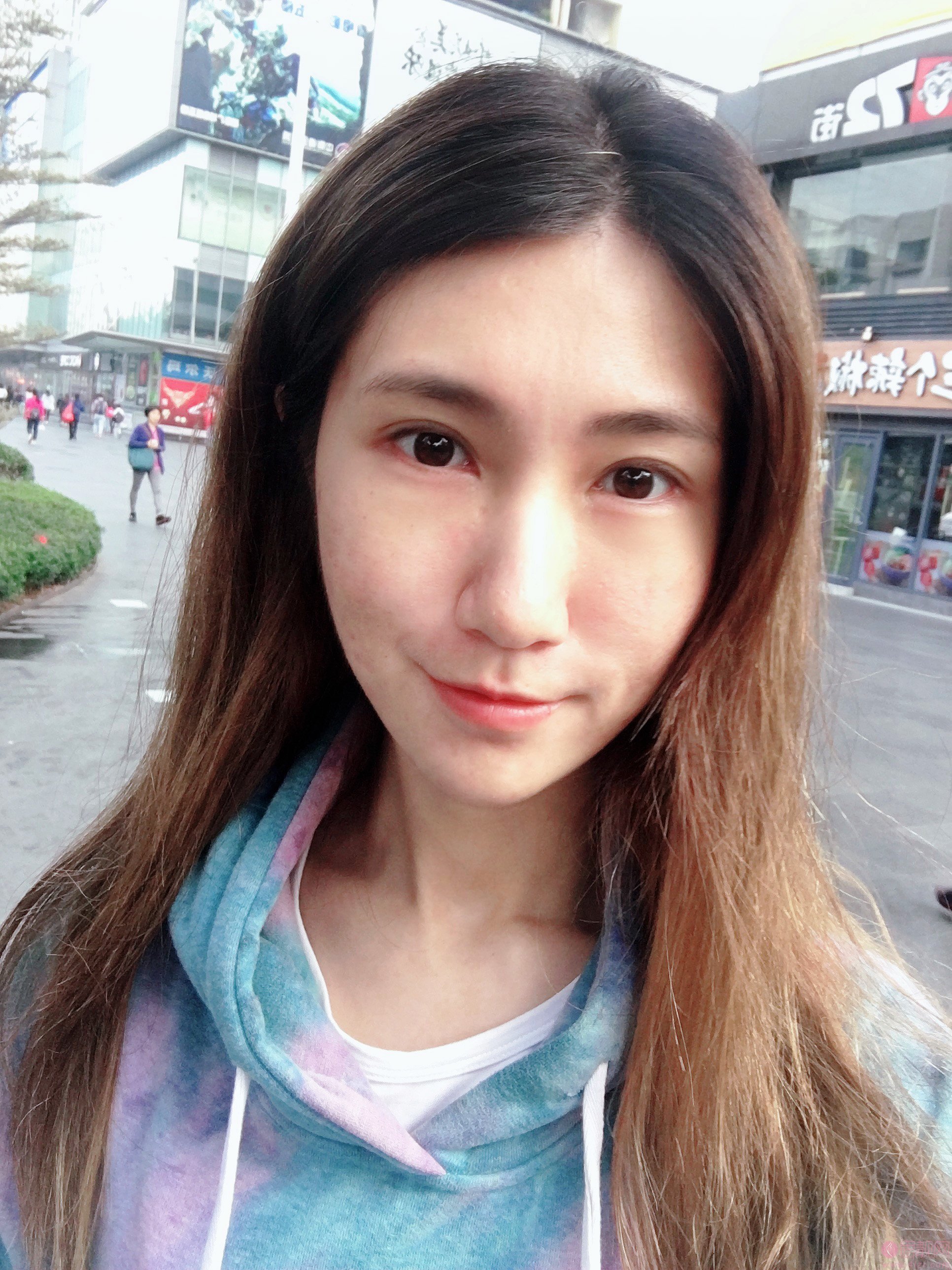 果酸换肤治疗痘坑效果怎么样？术前术后真人案例对比效果展示