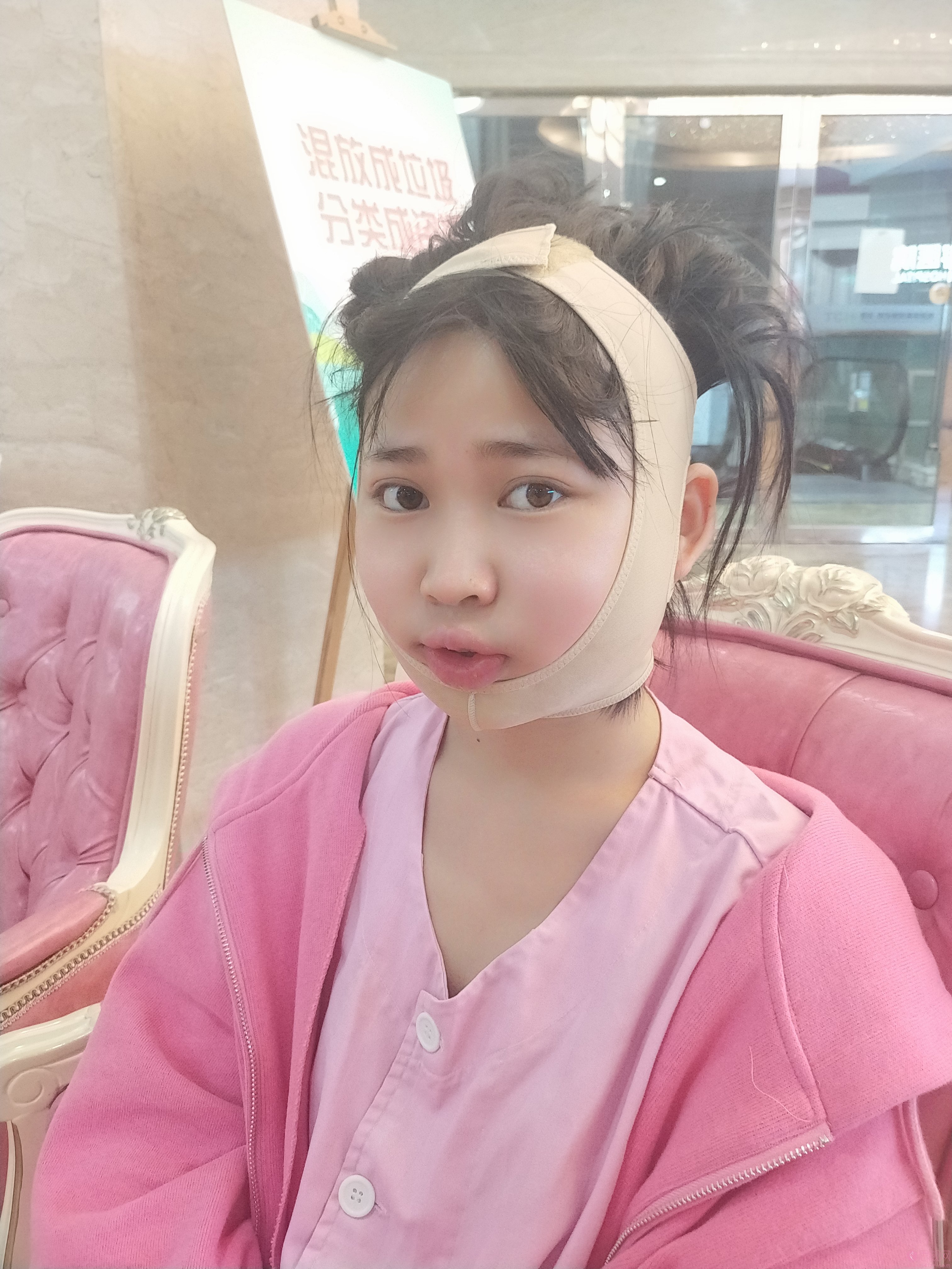 姜民范磨下颌角怎么样？术后真人案例反馈