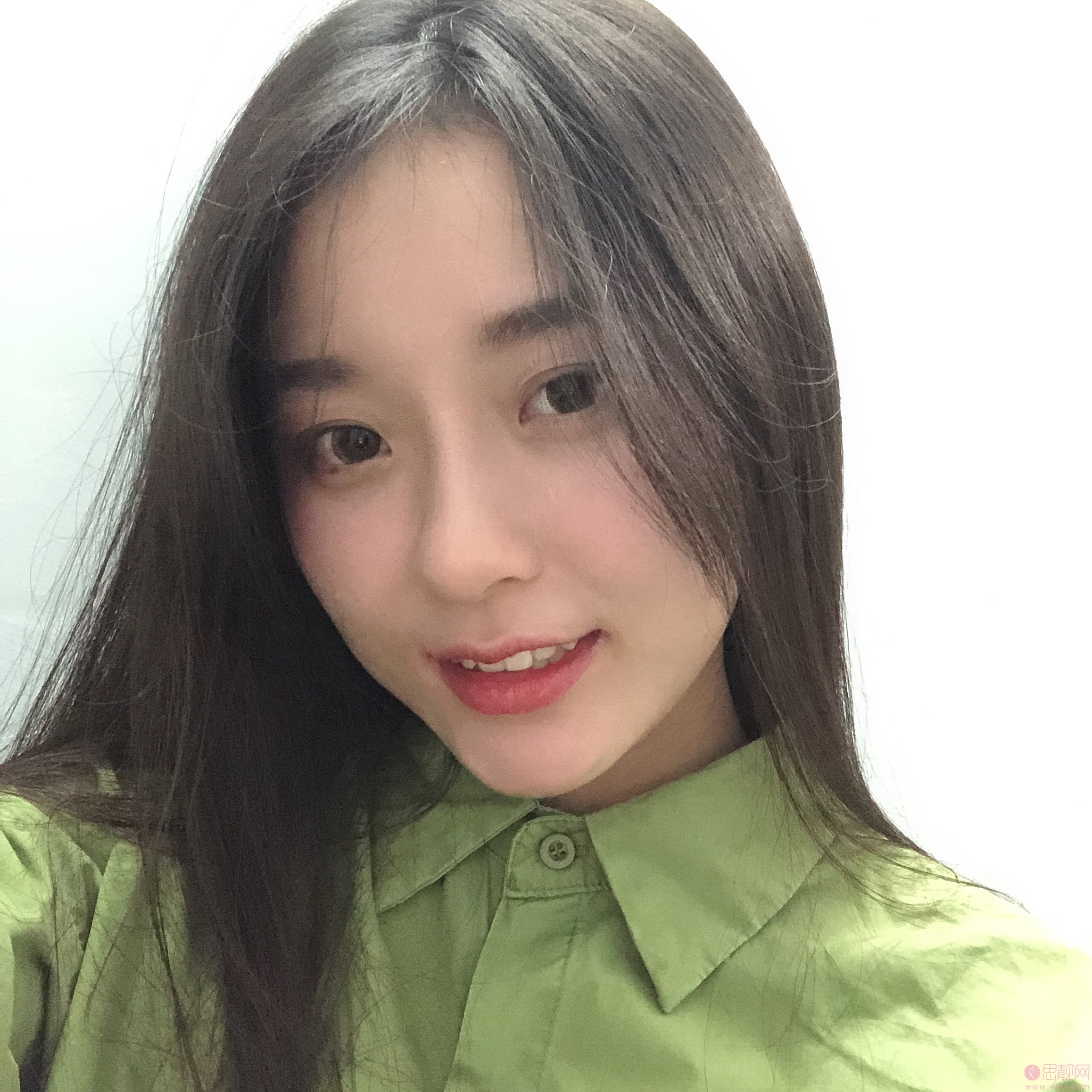 广州曙光整形医院价格表曝光+玻尿酸丰面颊真人案例分享