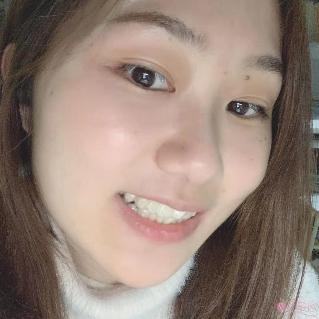 柏乐口腔和天使口腔哪个好