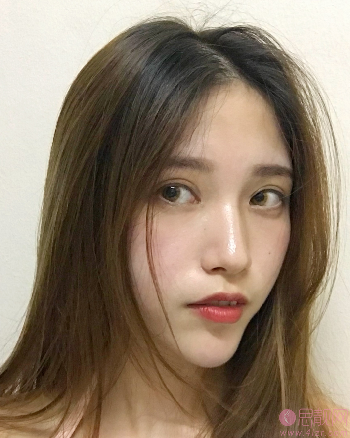 济南隅美整形怎么样？2021年价格表曝光+双眼皮案例分享