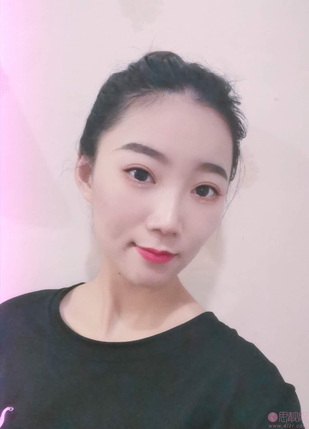 上虞艺美医疗整形医院做双眼皮多少钱？附案例及2021年价格表发布