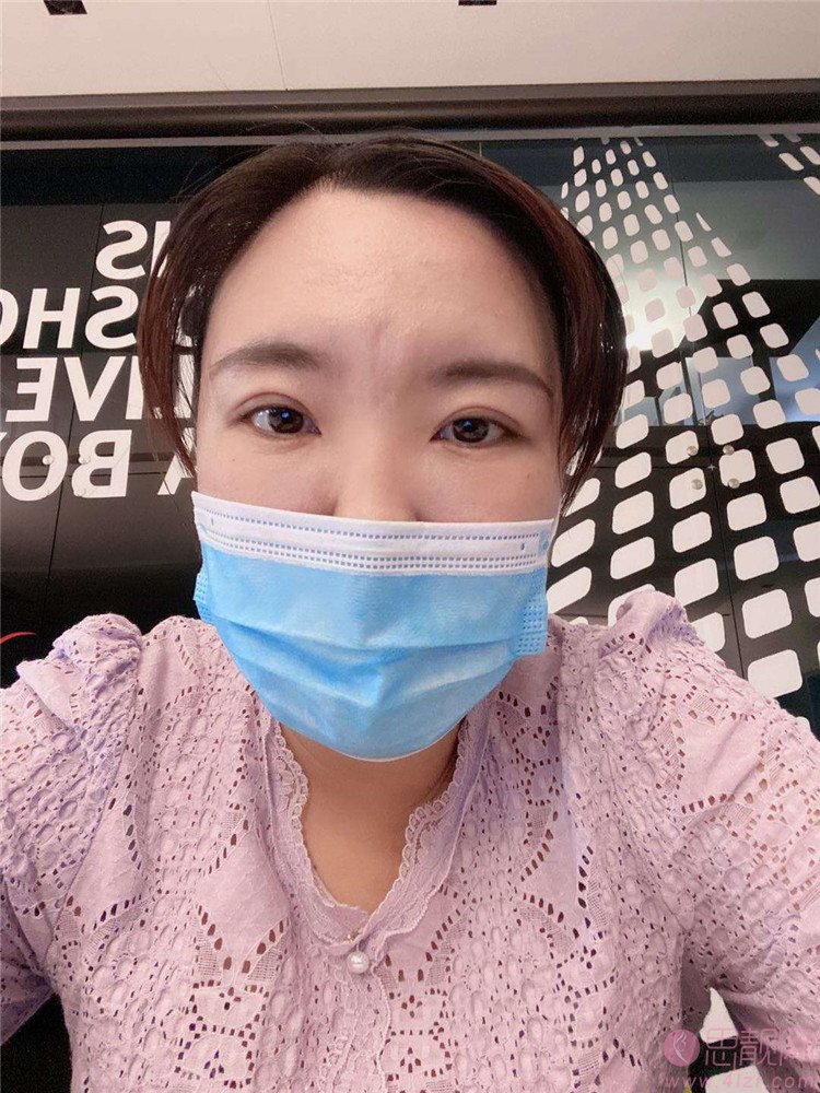 上海美诗沁去眼袋效果好吗?附祛眼袋术后案例分享+2021年价格表曝光