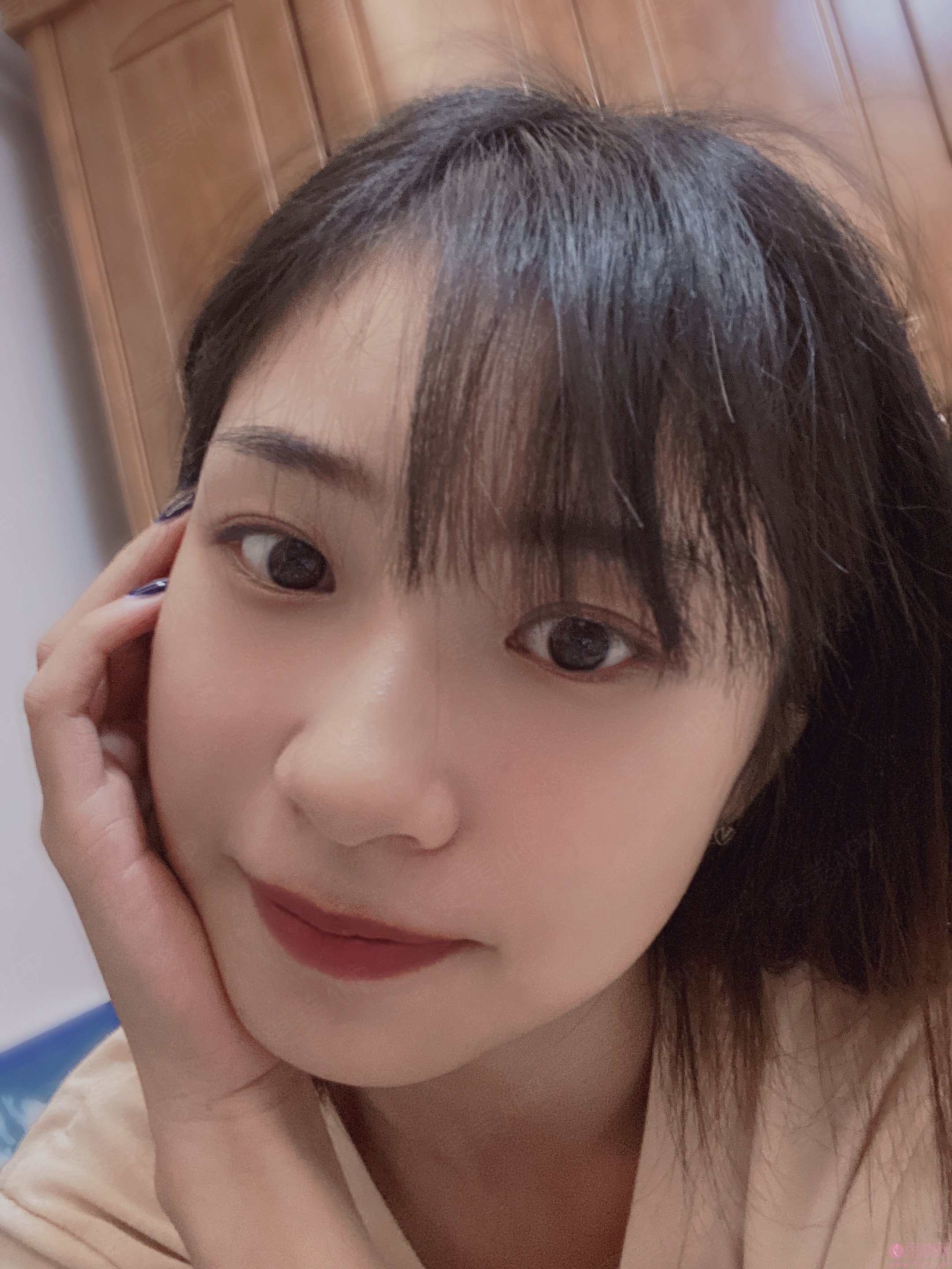 张立天做下颌角怎么样？2021年价格表曝光+术后真人案例反馈