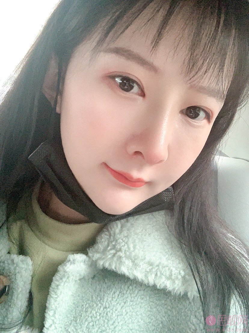 西安美立方李宇翔医生隆鼻怎么样？附隆鼻案例反馈+2021年价格表一览