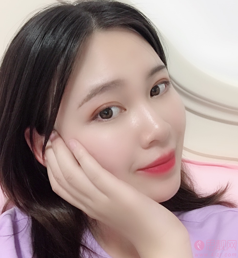 郑州美莱李俊霞医生隆鼻怎么样？术后真人案例分享+2021年价格表发布