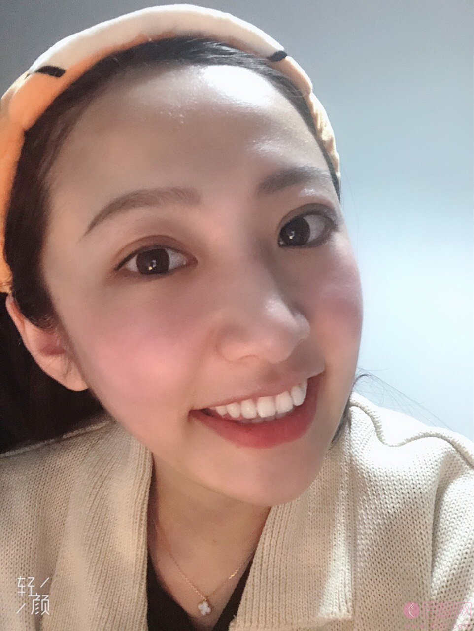 天津中诺口腔医院口碑怎么样?牙齿矫正案例分享+2021年价格表曝光