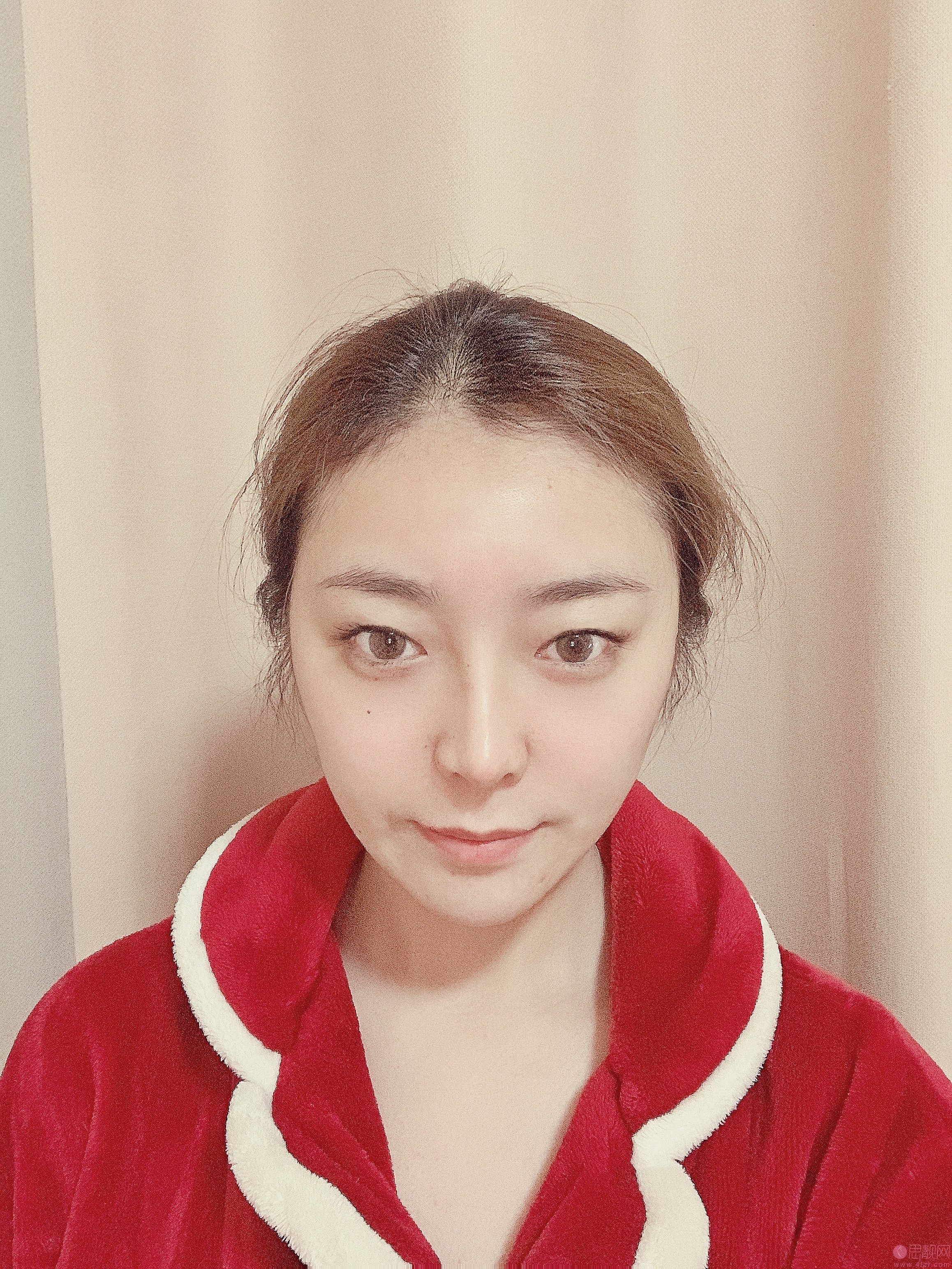 贵阳华美美容医院正规吗?医院简介+双眼皮术后真人案例分享