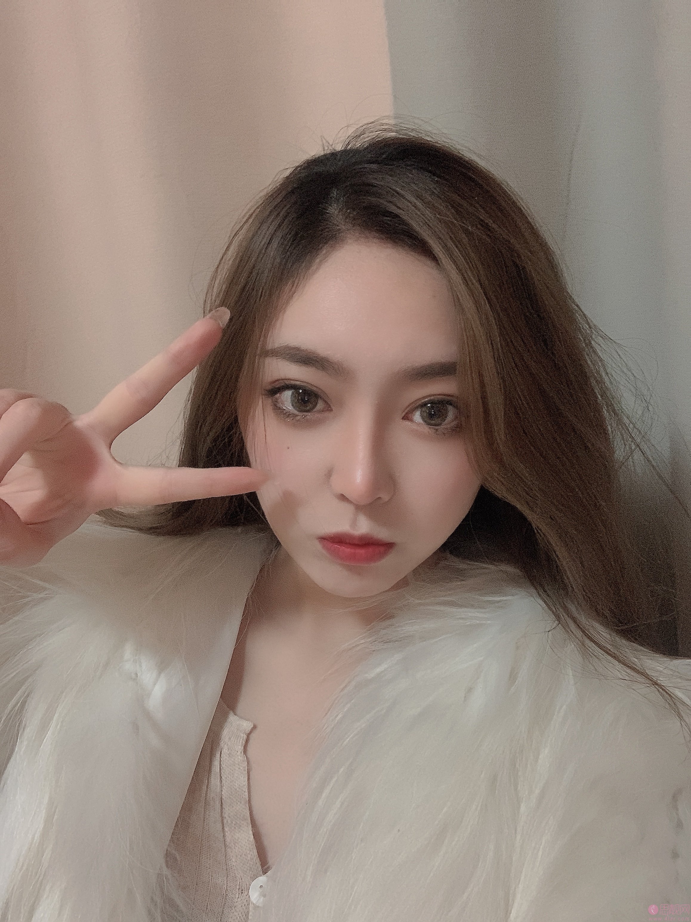 贵阳华美美容医院正规吗?医院简介+双眼皮术后真人案例分享