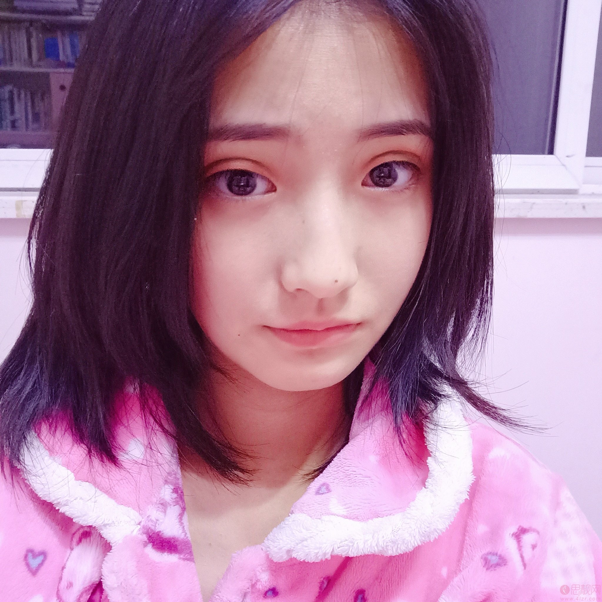北京吴焱秋双眼皮做的咋样？附双眼皮真人案例分享+2021年价格表曝光