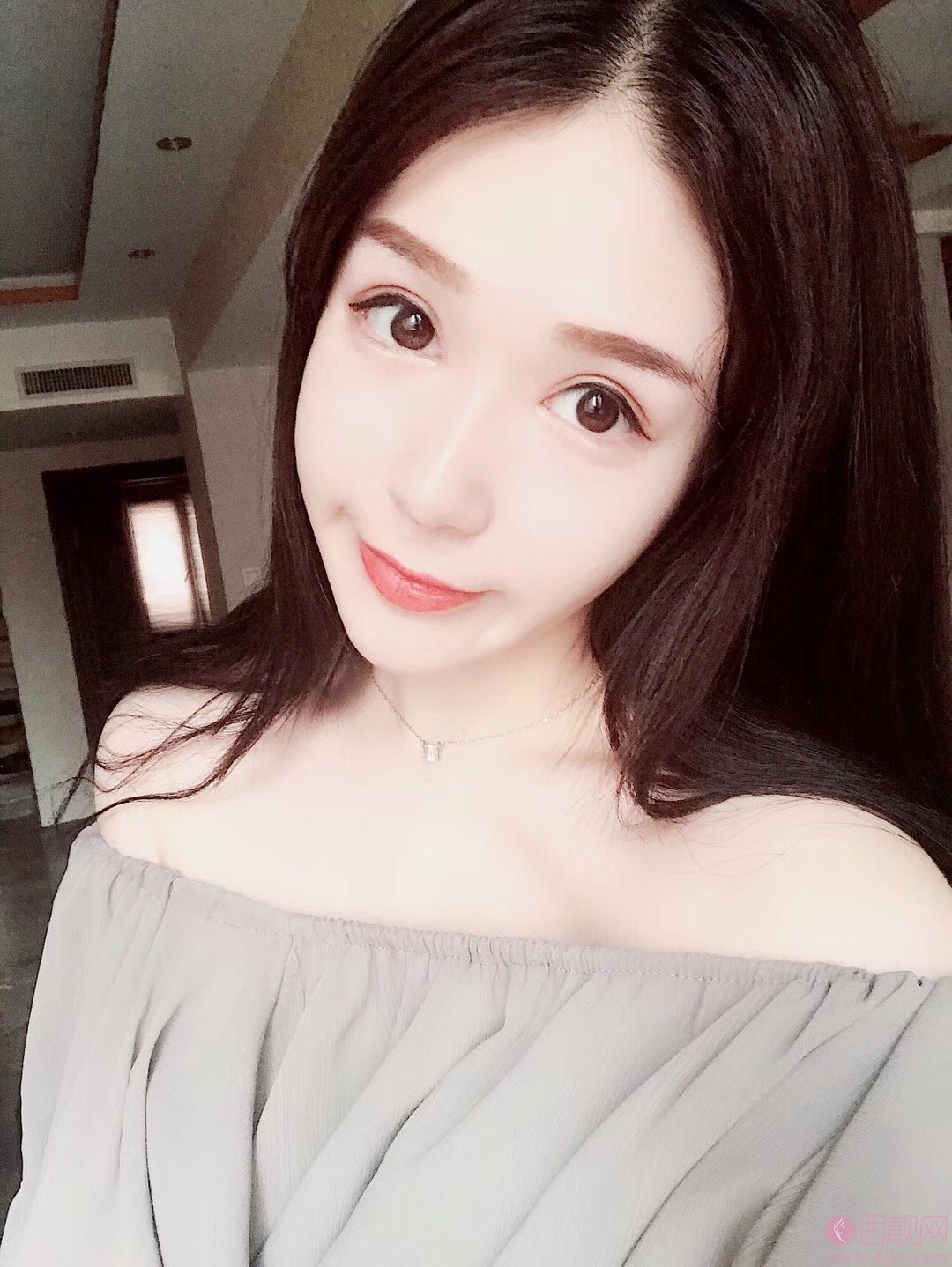 沈阳金皇后做双眼皮好吗?术后真人案例分享及价格表明细曝光