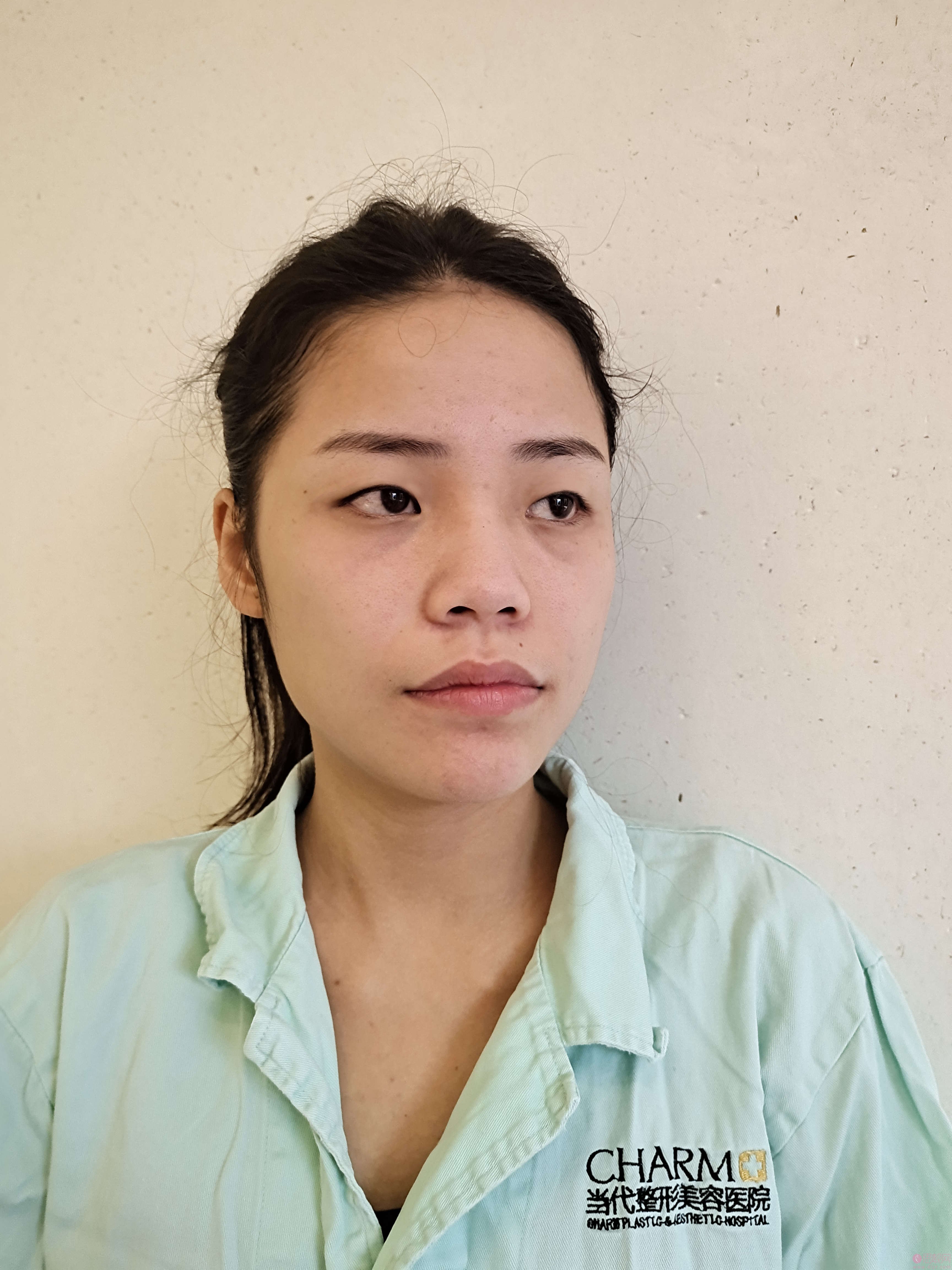 重庆当代整形美容医院2021价格表公开，附双眼皮真人案例反馈