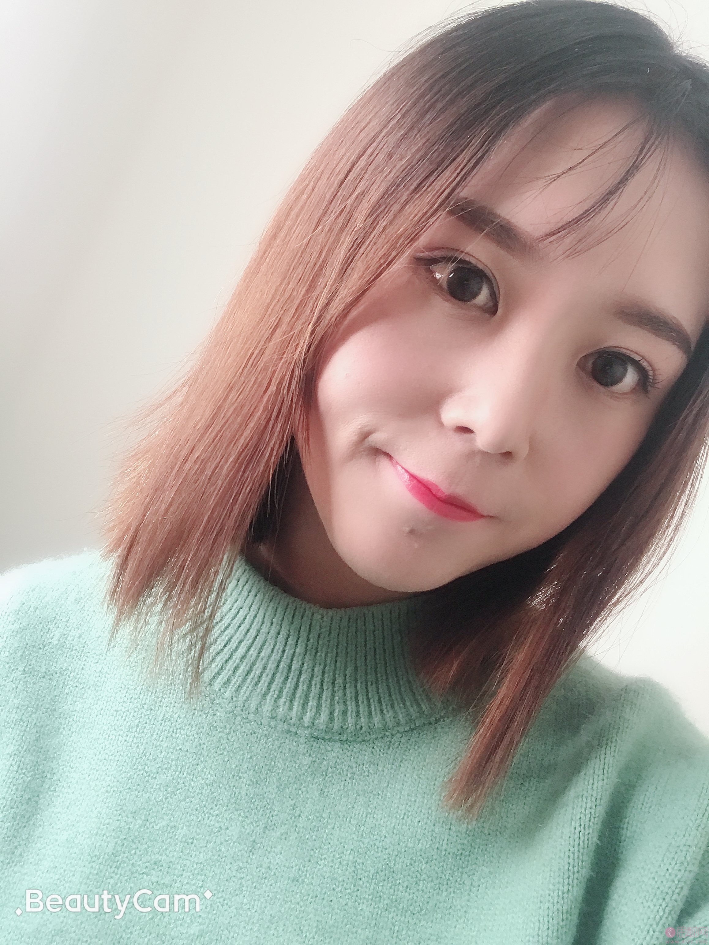 郑州辰星医院做双眼皮怎么样?附双眼皮真人案例分享+2021价格表曝光
