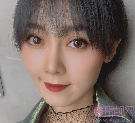 上海赵鹏做鼻子怎么样?看看我的鼻子案例就知道了