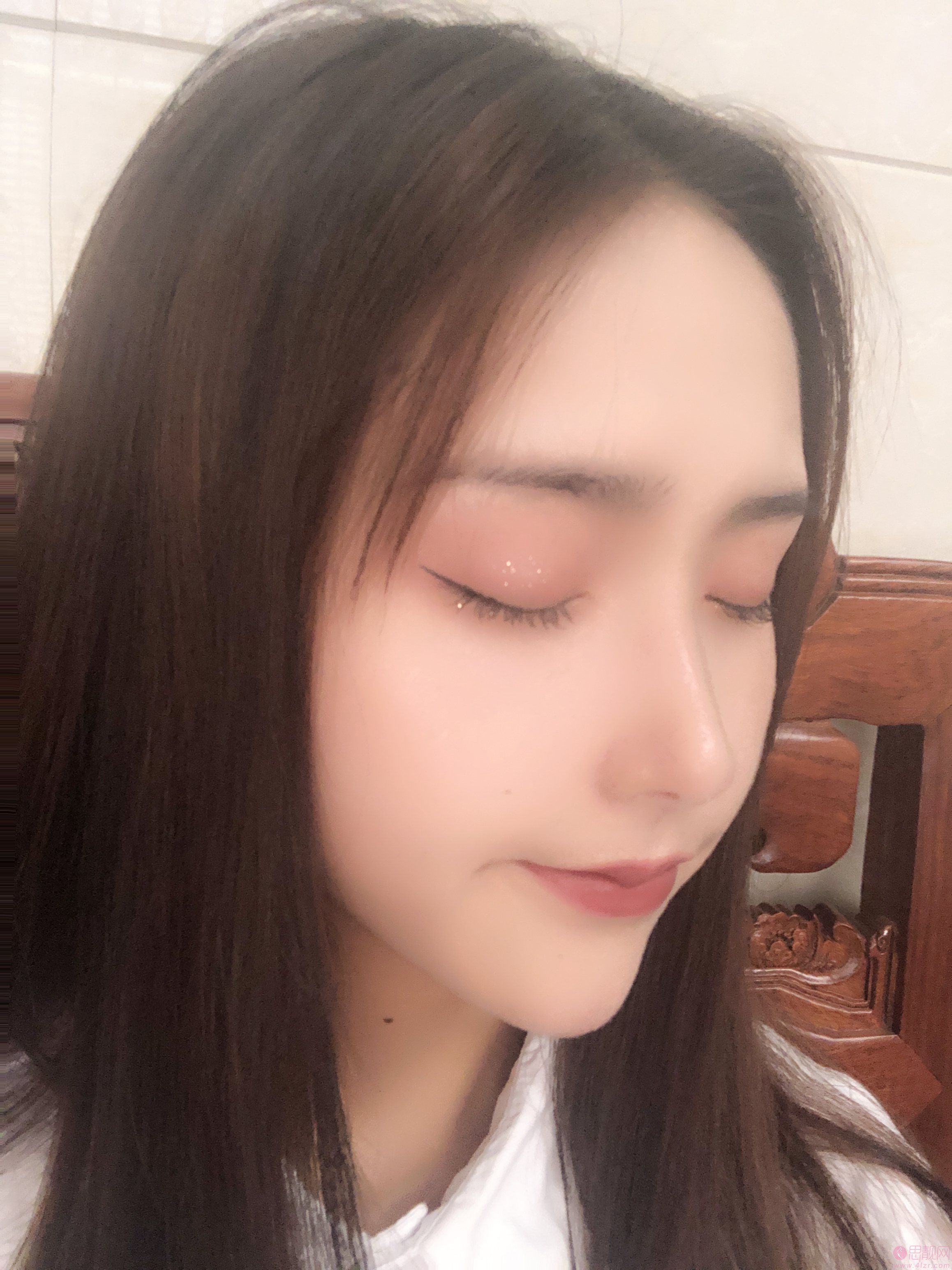 上海艺星整形医院隆鼻如何?多少钱?2021价格表发布+隆鼻真人案例反馈