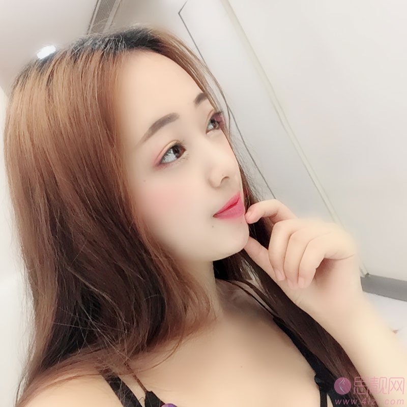 殷佳鹏医生做鼻子好不好?附隆鼻案例及2021年价格表公开