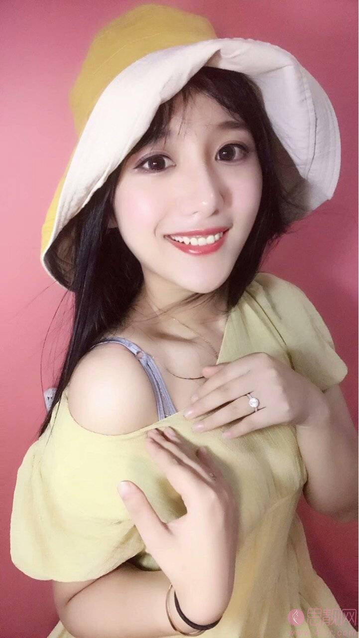 北京润美玉之光价目表曝光+王明利医生自体脂肪填充案例