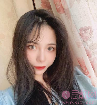 北京大学第三医院植发怎么样?发际线移植术后效果一览