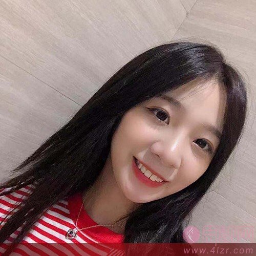 南京热玛吉认证授权医院名单曝光+术后真人案例分享