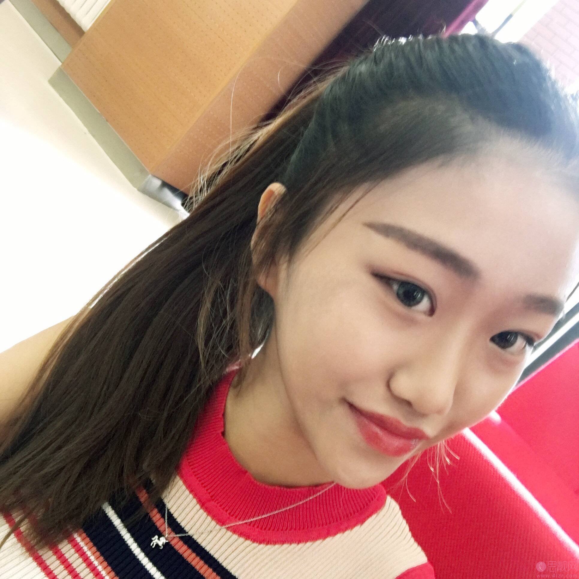 北京加减美口碑怎么样?附医院介绍及埋线提升真人案例分享