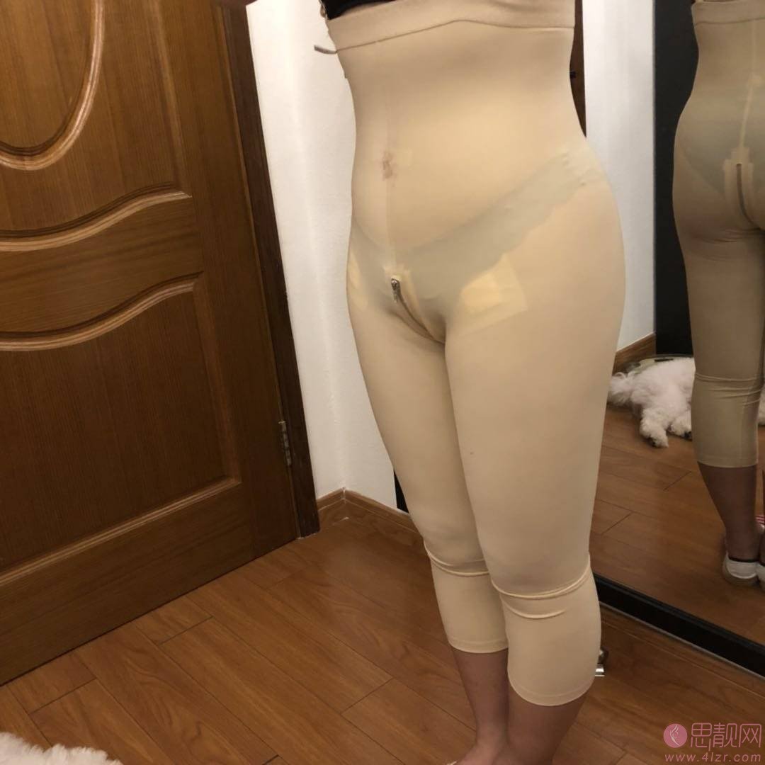 北京亚楠容悦吸脂怎么样?附吸脂瘦大腿真人案例分享