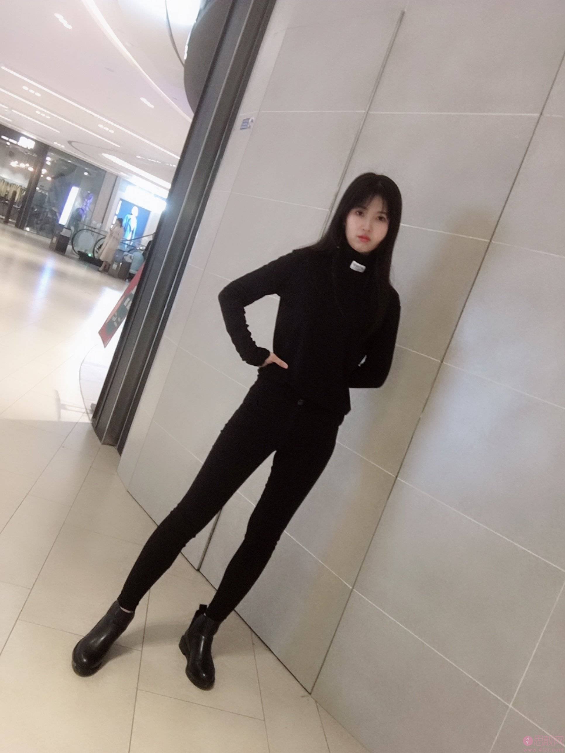 北京亚楠容悦吸脂怎么样?附吸脂瘦大腿真人案例分享