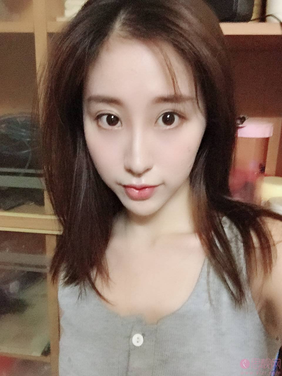 广州美莱2021整形价格表全新上线+光子嫩肤术后真人案例分享
